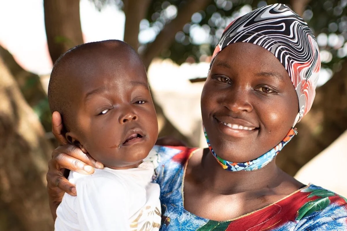 Woman holding young baby with special needs in Uganda