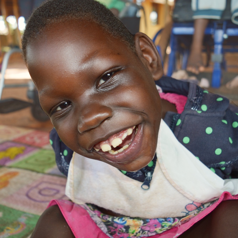 Ugandan girl smiling with special needs 